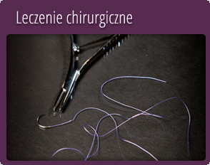 Leczenie chirurgiczne